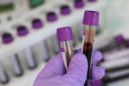 Blood test detects injury